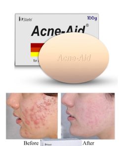 Acne Aid  Acne Conrol Soap 100g